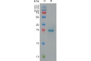 Butyrophilin, Subfamily 3, Member A1 (BTN3A1) (AA 1-218) protein (His tag)