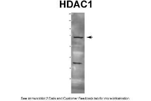 WB Suggested Anti-HDAC1 Antibody  Titration: 1 ug/ml Positive Control: Rat tissue (HDAC1 抗体  (C-Term))