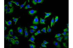 Immunofluorescence staining of A549 cells with ABIN7173285 at 1:133, counter-stained with DAPI. (TMEM88 抗体  (AA 109-159))