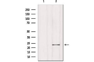 Western blot analysis of extracts from Hela, using RGS1 Antibody. (RGS1 抗体  (Internal Region))