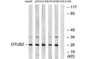 Western blot analysis of extracts from COLO/HepG2/Jurkat/293/HT-29 cells, using OTUB2 Antibody. (OTUB2 抗体  (AA 133-182))