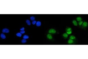 anti-Ribosomal Protein S6 Kinase, 90kDa, Polypeptide 5 (RPS6KA5) (AA 540-665) antibody