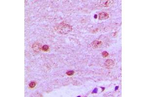 Immunohistochemical analysis of PAK7 staining in human brain formalin fixed paraffin embedded tissue section. (PAK7 抗体  (C-Term))