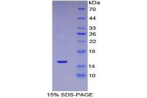 SDS-PAGE analysis of Mouse Complement 1 Inhibitor Protein. (SERPING1 蛋白)