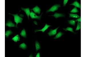 Image no. 4 for anti-Spermine Synthase, SMS (SMS) antibody (ABIN1501098) (SMS 抗体)