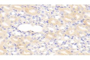 Detection of C1INH in Mouse Kidney Tissue using Polyclonal Antibody to Complement 1 Inhibitor (C1INH)