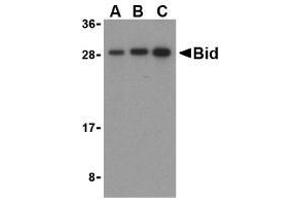 Western blot analysis of Bid in mouse lung cell lysates with AP30147PU-N Bid antibody at (A) 0. (BID 抗体  (C-Term))