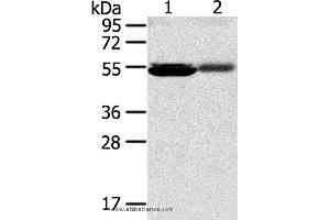 Western blot analysis of Human kidney pericarcinous and kidney cancer tissue, using SLC17A1 Polyclonal Antibody at dilution of 1:200 (SLC17A1 抗体)