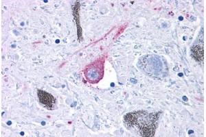 Immunohistochemistry (IHC) image for anti-G Protein-Coupled Receptor 50 (GPR50) (C-Term) antibody (ABIN1049059)