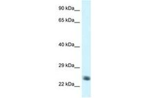 Image no. 1 for anti-NADH Dehydrogenase (Ubiquinone) Fe-S Protein 8, 23kDa (NADH-Coenzyme Q Reductase) (NDUFS8) (AA 114-163) antibody (ABIN6747459) (NDUFS8 抗体  (AA 114-163))