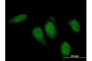 Immunofluorescence of monoclonal antibody to TTN on HeLa cell. (Titin 抗体  (AA 1-110))