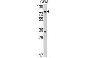 Western blot analysis of TGM4 Antibody (Center) in CEM cell line lysates (35ug/lane).