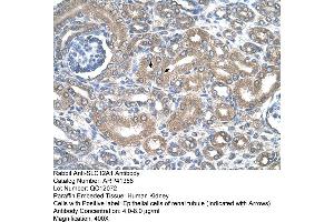 Immunohistochemistry (IHC) image for anti-Solute Carrier Family 12 (Sodium/potassium/chloride Transporters), Member 1 (SLC12A1) (N-Term) antibody (ABIN2776780)