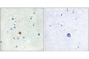 Immunohistochemistry analysis of paraffin-embedded human brain tissue, using IRF3 (Ab-396) Antibody. (IRF3 抗体  (AA 362-411))