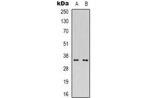 Western blot analysis of CDC42EP4 expression in Hela (A), Jurkat (B) whole cell lysates.
