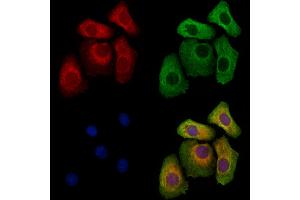 ABIN6262800 and ABIN6273259 staining Hela cells by IF/ICC. (KIDINS220 抗体  (Internal Region))