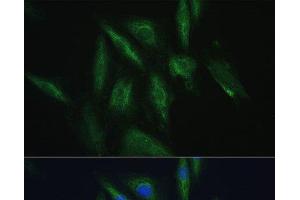 Immunofluorescence analysis of H9C2 cells using SRPRB Polyclonal Antibody at dilution of 1:100. (SRPRB 抗体)