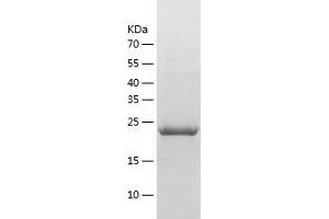 Western Blotting (WB) image for Coagulation Factor III (thromboplastin, Tissue Factor) (F3) (AA 31-251) protein (His tag) (ABIN7122418) (Tissue factor Protein (AA 31-251) (His tag))