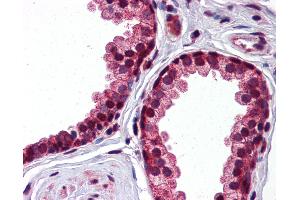 Immunohistochemistry (IHC) image for anti-serpin Peptidase Inhibitor, Clade A (Alpha-1 Antiproteinase, Antitrypsin), Member 3 (SERPINA3) (AA 254-303) antibody (ABIN768964)