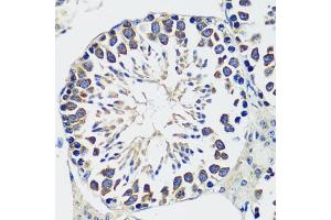 Immunohistochemistry (IHC) image for anti-Coiled-Coil Domain Containing 124 (CCDC124) (AA 1-223) antibody (ABIN7266433)