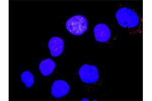Proximity Ligation Assay (PLA) image for anti-PTK2B Protein tyrosine Kinase 2 beta (PTK2B) (AA 1-1009) antibody (ABIN515514)
