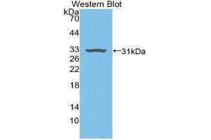 Western Blotting (WB) image for anti-Plasminogen (PLG) (AA 191-433) antibody (ABIN1078448) (PLG 抗体  (AA 191-433))