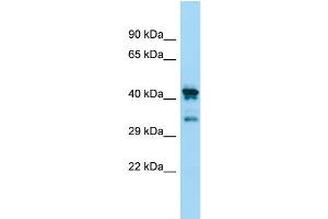WB Suggested Anti-CHID1 Antibody Titration: 1. (CHID1 抗体  (N-Term))