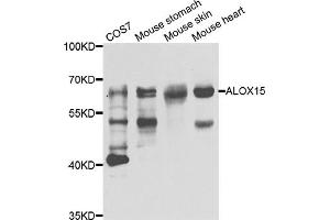 Western blot analysis of extracts of various cell lines, using ALOX15 antibody (ABIN5975430) at 1/1000 dilution. (ALOX15 抗体)