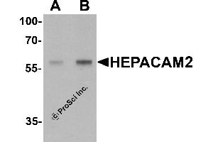 Western Blotting (WB) image for anti-HEPACAM Family Member 2 (HEPACAM2) (C-Term) antibody (ABIN1077405) (HEPACAM2 抗体  (C-Term))