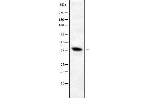 Western blot analysis of V-ATPase D1 using HeLa whole cell lysates (ATP6V0D1 抗体  (Internal Region))