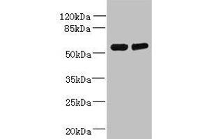 Western blot All lanes: TCTE1 antibody at 3 μg/mL Lane 1: U251 whole cell lysate Lane 2: Mouse brain tissue Secondary Goat polyclonal to rabbit IgG at 1/10000 dilution Predicted band size: 56 kDa Observed band size: 56 kDa (TCTE1 抗体  (AA 285-501))
