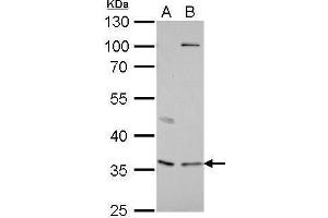 WB Image Decorin antibody detects DCN protein by Western blot analysis. (Decorin 抗体)