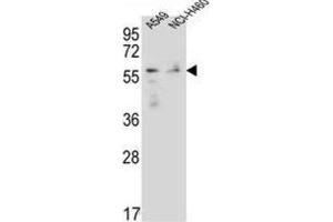Western Blotting (WB) image for anti-Forkhead Box N1 (FOXN1) antibody (ABIN2996514) (FOXN1 抗体)