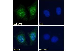 ABIN184743 Immunofluorescence analysis of paraformaldehyde fixed MCF7 cells, permeabilized with 0.