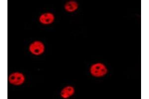 ABIN6277203 staining HepG2 by IF/ICC. (Histone 3 抗体  (H3K36me3))