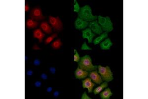 Phospho-A20/TNFAIP3 (Ser381) Antibody staining Hela cells(heat shock treatment) by IF/ICC. (TNFAIP3 抗体  (pSer381))