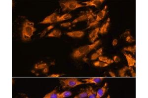 Immunofluorescence analysis of C6 cells using ASPM Polyclonal Antibody at dilution of 1:100. (ASPM 抗体)