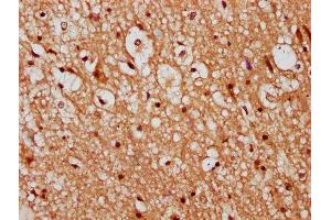 IHC image of ABIN7147330 diluted at 1:300 and staining in paraffin-embedded human brain tissue performed on a Leica BondTM system. (TMEM2 抗体  (AA 734-866))