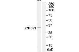 Western blot analysis of extracts from HeLa cells, using ZNF691 antibody. (ZNF691 抗体)