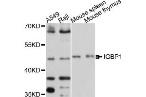 Western blot analysis of extracts of various cell lines, using IGBP1 antibody (ABIN5997954) at 1/1000 dilution.