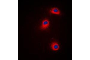 Immunofluorescent analysis of CaMK1 alpha (pT177) staining in Jurkat cells. (CAMK1 抗体  (pSer177))
