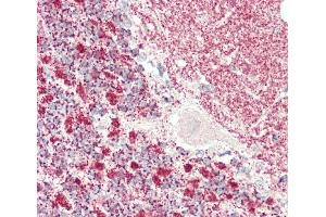 Immunohistochemistry (Paraffin-embedded Sections) (IHC (p)) image for anti-Kinesin Light Chain 1 (KLC1) (AA 389-415) antibody (ABIN652577)