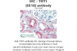 Image no. 1 for anti-CD90 (THY1) antibody (ABIN1724058) (CD90 抗体)