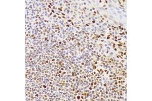 Immunohistochemistry (Paraffin-embedded Sections) (IHC (p)) image for anti-Nuclear Autoantigenic Sperm Protein (Histone-Binding) (NASP) (AA 180-449) antibody (ABIN6144374)