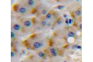 Immunohistochemistry (IHC) image for anti-Colony Stimulating Factor 1 Receptor (CSF1R) (AA 768-928) antibody (ABIN1174692)