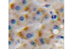 Used in DAB staining on fromalin fixed paraffin-embedded Liver tissue (CSF1R 抗体  (AA 768-928))