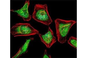 Fluorescent confocal image of HeLa cell stained with ATF7 antibody at 1:25. (ATF7 抗体  (AA 68-96))
