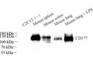 Western blot analysis of CD177 (ABIN7073372)at dilution of 1: 1000 (CD177 抗体)