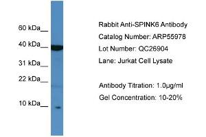 Western Blotting (WB) image for anti-serine Peptidase Inhibitor, Kazal Type 6 (SPINK6) (Middle Region) antibody (ABIN2786464)
