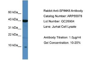 WB Suggested Anti-SPINK6  Antibody Titration: 0. (SPINK6 抗体  (Middle Region))